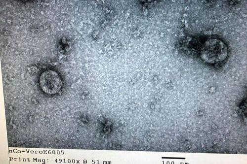 Việt Nam nuôi cấy và phân lập thành công virus corona chủng mới