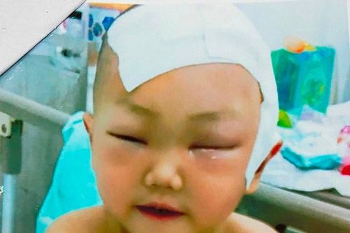 Giúp đỡ cháu bé bị ung thư não
