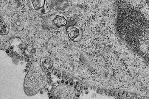 Virus Covid-19 có ở đâu trong môi trường xung quanh chúng ta?