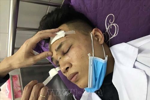 Bắt tạm giam các đối tượng hành hung bác sỹ ở Bình Giang, Hải Dương