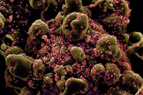 Lý do virus nCoV khó bị tiêu diệt hoàn toàn