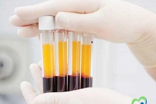Có thể lấy huyết tương của người bị bệnh Covid-19 đã khỏi bệnh để chữa cho người đang bị bệnh hay không?