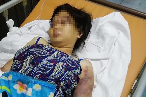 Nhóm người tra tấn cô gái đến chết thai bị truy tố
