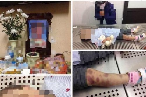 Xử lý thế nào với cặp vợ chồng nghi bạo hành bé gái 3 tuổi tử vong?