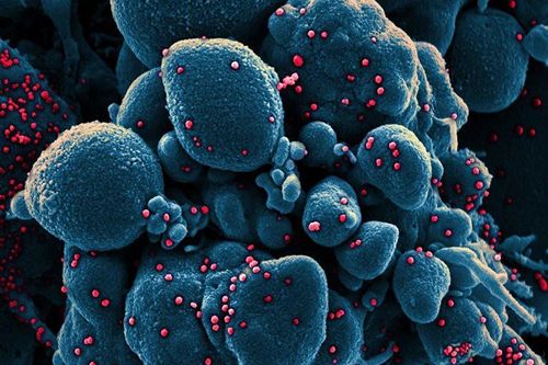 Hình ảnh virus SARS-CoV-2 tấn công tế bào