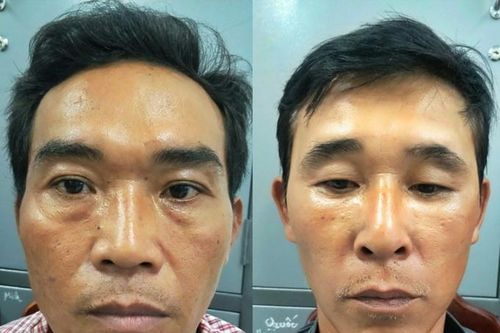 6 ngày truy nóng 2 nghi phạm cướp giật