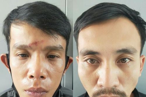 Mang cây cảnh vừa trộm được đi tiêu thụ thì gặp công an