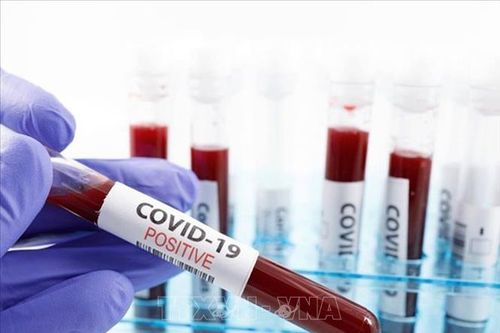 Bỉ bắt đầu sản xuất bộ xét nghiệm phát hiện nhanh kháng thể virus SARS-CoV-2
