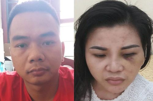 Bắt nhóm cướp dùng chiêu 'mỹ nữ' để dụ nạn nhân vào nhà nghỉ