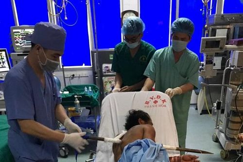 Thanh xà beng dài 1m đâm xuyên ngực người đàn ông
