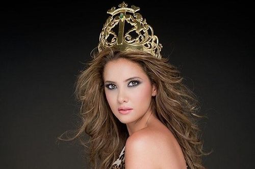 Hoa hậu hoàn vũ Colombia - Daniella Alvarez phải cưa chân vì biến chứng