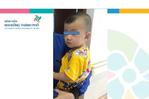 2 ngày nín thở lấy mảnh gương vỡ khỏi bụng bé trai 10 tháng tuổi