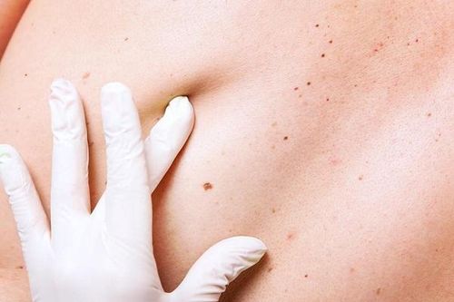 Những dấu hiệu tưởng đơn giản nhưng cảnh báo ung thư ở phụ nữ