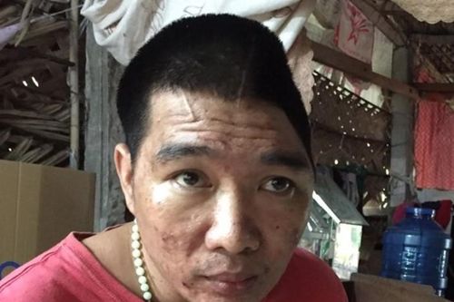 Mẹ nghèo nuôi con bệnh tật