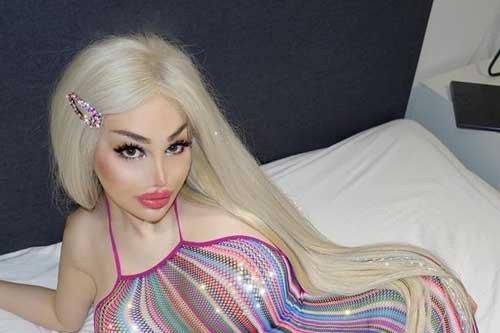 9X trải qua 10 lần phẫu thuật thẩm mỹ để giống búp bê Barbie