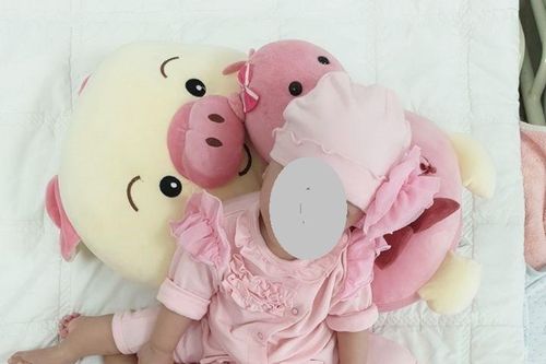 TPHCM: Chuẩn bị tách ca song sinh dính liền 'dùng chung một tã'