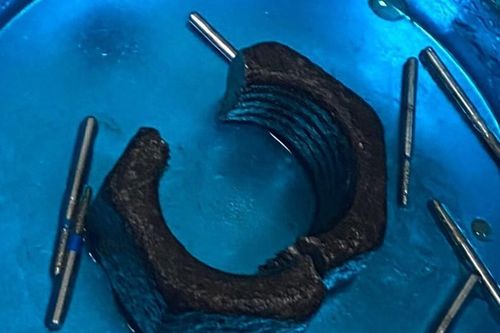 Nhập viện vì tự nhét 'cậu nhỏ' vào chiếc đai ốc lục giác