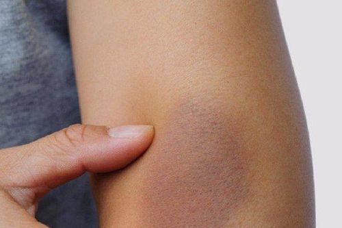 Những dấu hiệu cảnh báo cơ thể bạn đang già đi nhanh chóng