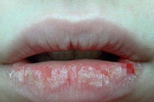 4 dấu hiệu trên khuôn mặt cảnh báo bệnh tật, cần đi khám ngay kẻo hối hận không kịp