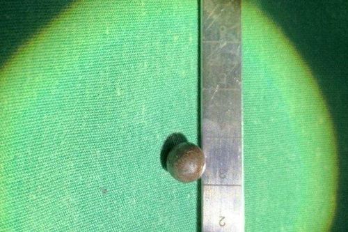 Phẫu thuật cứu sống bệnh nhân 59 tuổi bị đạn bi găm vào cột sống cổ