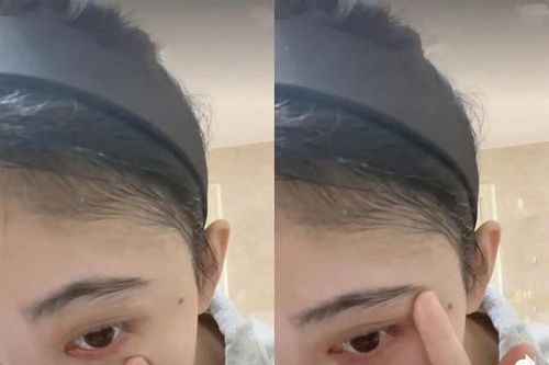 Cúc Tịnh Y lộ bằng chứng 'dao kéo' trong clip rửa mặt nhưng không dám chạm vào mũi?