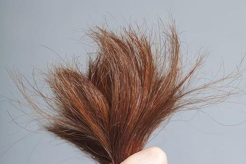Dấu hiệu tố cáo cơ thể bạn đang thiếu chất trầm trọng