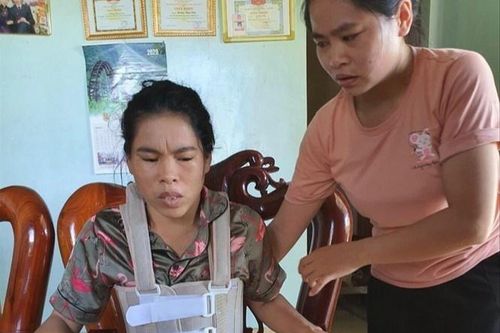 Một phụ nữ bị chồng bạo hành suốt 11 năm