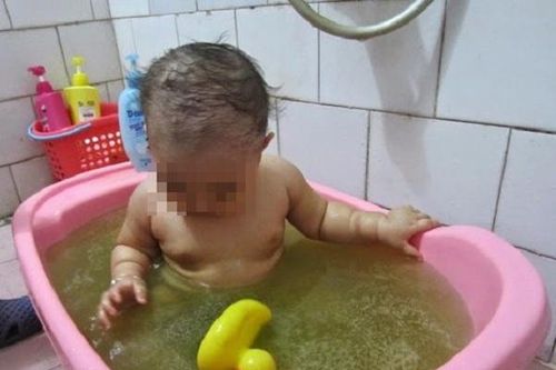4 sai lầm của cha mẹ khiến bệnh da liễu mùa hè ở trẻ ngày càng nặng