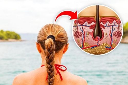 4 kiểu tóc dễ gây ra cơn đau đầu
