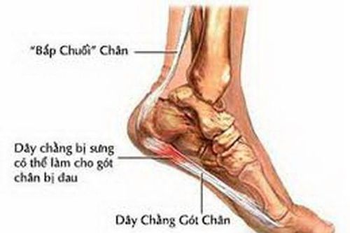 Dùng thuốc khi bị đau gót chân