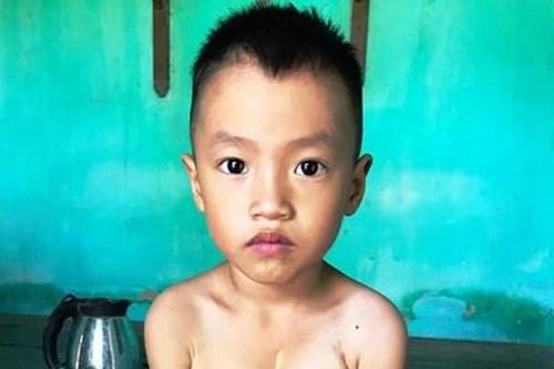 Cháu bé bệnh tim bẩm sinh cần giúp đỡ