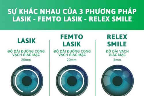 Hỏi đáp xoay quanh các phương pháp phẫu thuật laser: Xóa cận-viễn-loạn phổ biến hiện nay (kỳ 1)