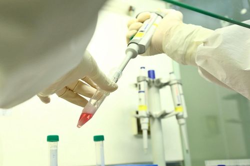 Trường hợp thứ 32 mắc COVID-19 tử vong vì bệnh lý nền nặng ở Việt Nam