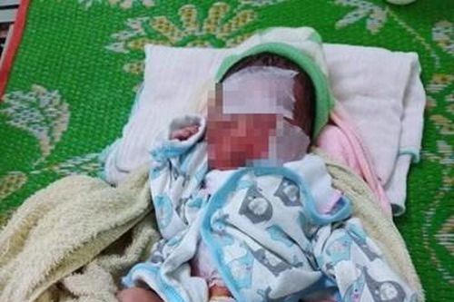Bàng hoàng phát hiện bé gái sơ sinh bị bỏ rơi cả ngày ngoài rẫy vắng