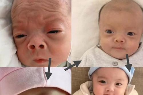 Con sinh ra xấu như người ngoài hành tinh, vài tháng sau mẹ ngỡ ngàng trước màn lột xác ngoạn mục