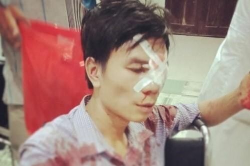 Cán bộ địa chính bị tố dùng xẻng đánh người nhập viện sau va chạm giao thông