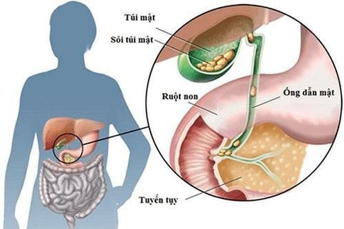 Áp-xe gan đường mật có nguy hiểm?