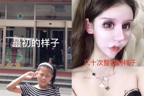 Fan hết hồn khi biết hot girl mạng xã hội 'sửa nát mặt' từ năm 13 tuổi