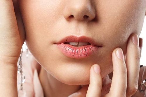 Vì sao bị khô miệng, điều trị thế nào?