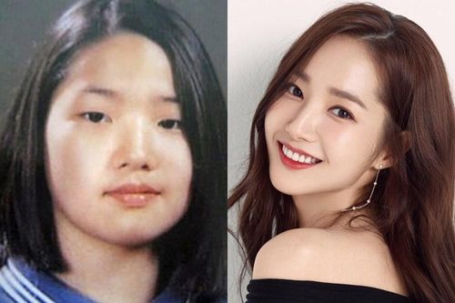 Sự thật gây sốc về bức ảnh của 'Nữ hoàng dao kéo' Park Min Young trước khi thẩm mỹ