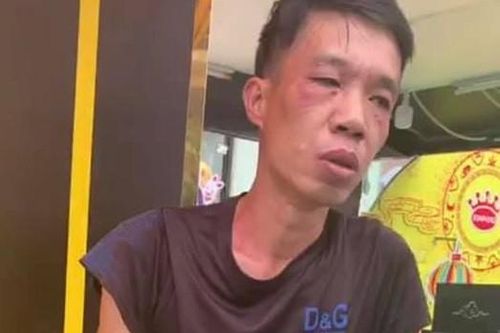 Chặn bắt tên trộm đang phóng xe máy tìm đường tẩu thoát