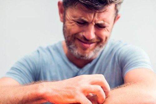 Vì sao gãi lại hết ngứa