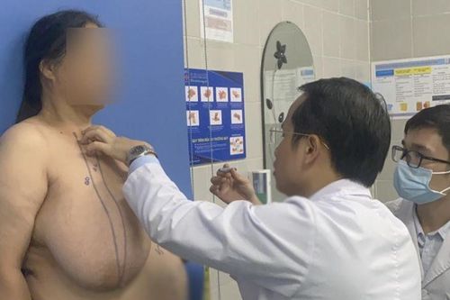 Tái tạo lại 'cặp núi đôi' khổng lồ hiếm gặp