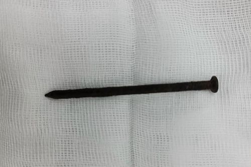 Suýt chết vì tự nuốt đinh sắt dài 8cm vào bụng