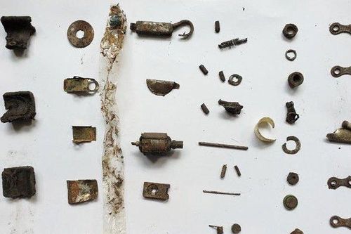 Nuốt nhiều dị vật kim loại, người đàn ông 35 tuổi nhập viện cấp cứu