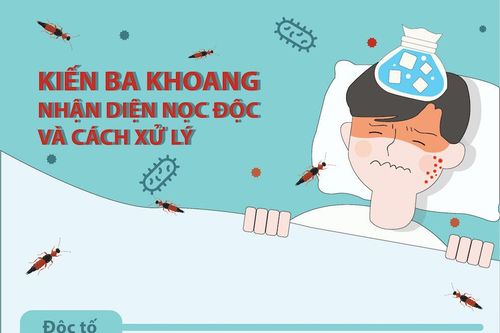 Cách xử lý khi bị kiến ba khoang đốt