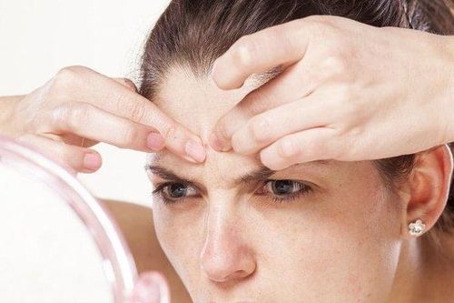 Vị trí nổi mụn cảnh báo gì về sức khỏe? - Mẹo trị mụn tự nhiên