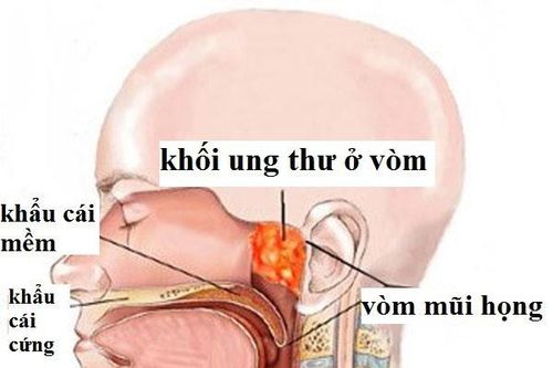 Đây là món cá nhiều người ưa thích được WHO xếp vào nhóm gây ung thư số 1, hãy dừng ăn ngay nếu không muốn mắc ung thư