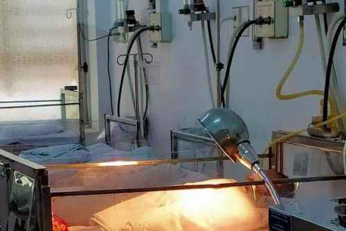 Bình Thuận: Bé sơ sinh bị buộc trong túi nylon bỏ rơi ven đường