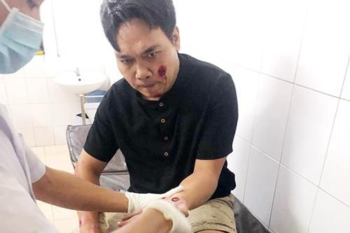 Đề nghị khen thưởng hai 'hiệp sĩ' bị thương khi truy bắt tội phạm